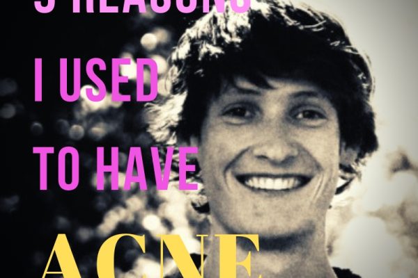 9 Reasons I Used To Have Acne